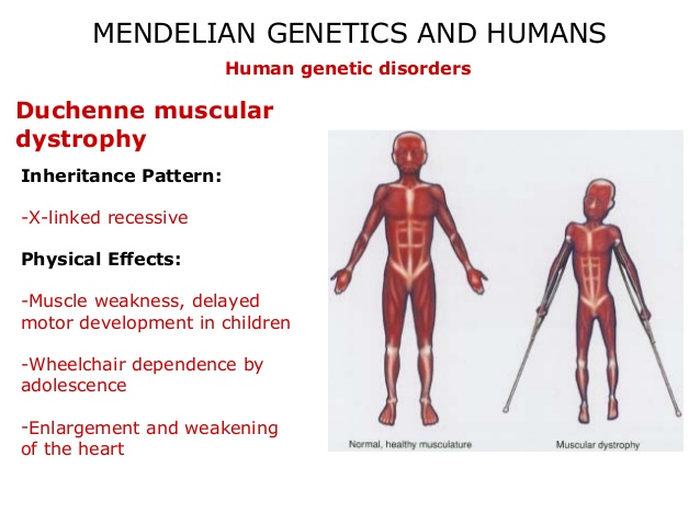 Duchenne Muscular Dystrophy