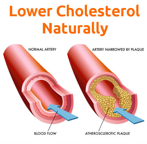 Dangerous Cholesterol Levels: Causes and Symptoms of the Issue