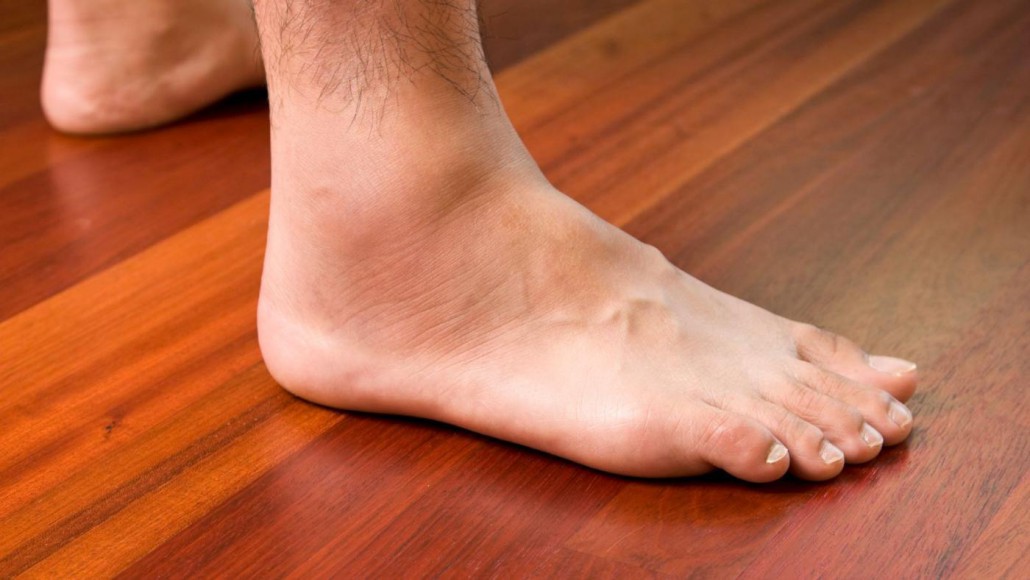 What Would Cause Swelling In Your Legs And Feet 19