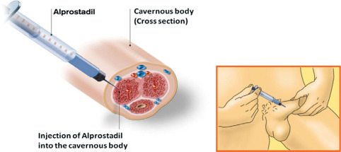 Alprostadil2