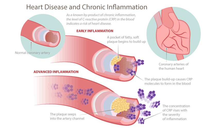 Symptoms of chronic inflammation