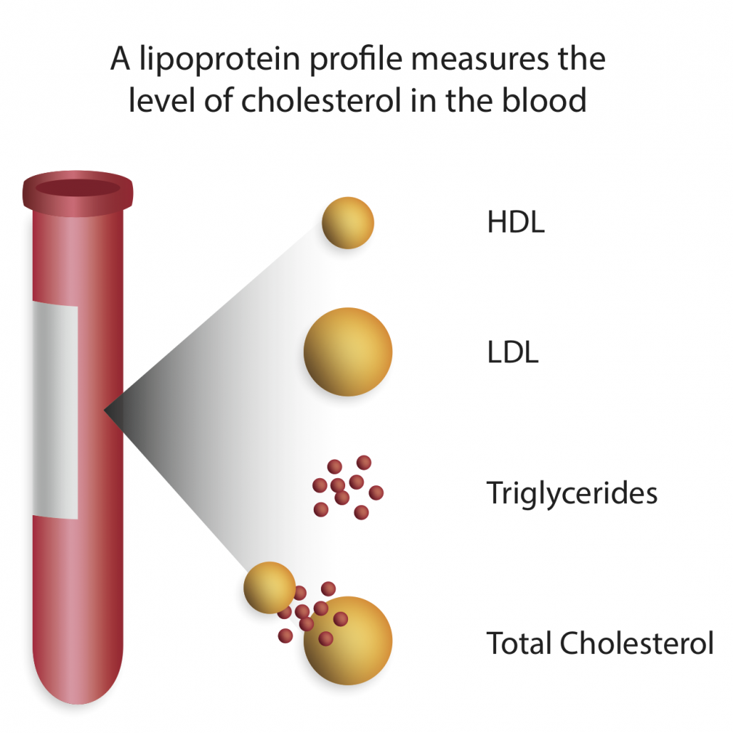 Cholesterol Level