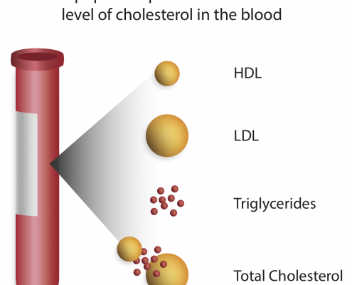 Cholesterol Level